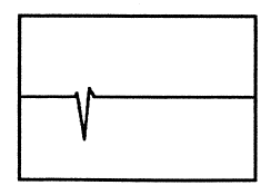 Figur 19: Tidsbilde - Vibrasjoner
