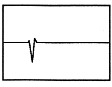 Figur 51: Tidsbilde - Vibrasjoner